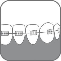 Зубна щітка Paro Swiss ortho brush child дитяча ортодонтична