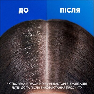 Шампунь і бальзам-ополіскувач Head & Shoulders 2 в 1 Цитрусова свіжість проти лупи, 330 мл