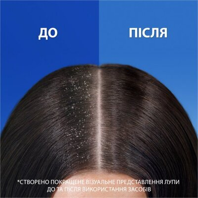 Шампунь і бальзам-ополіскувач Head & Shoulders 2 в 1 Основний догляд проти лупи, 360 мл
