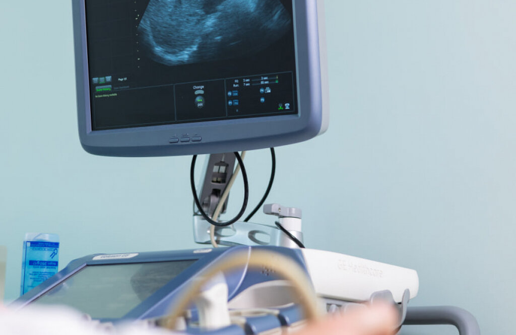 Репродуктивна клініка «ЛІТА»