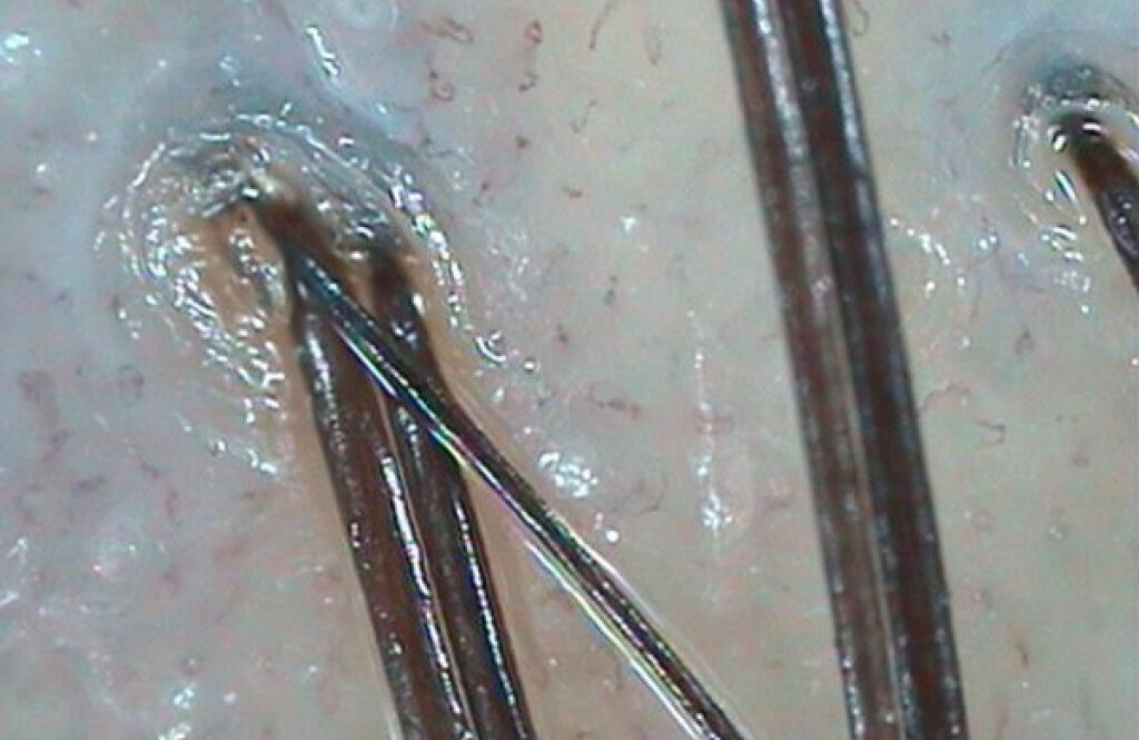 Дерматологія плюс