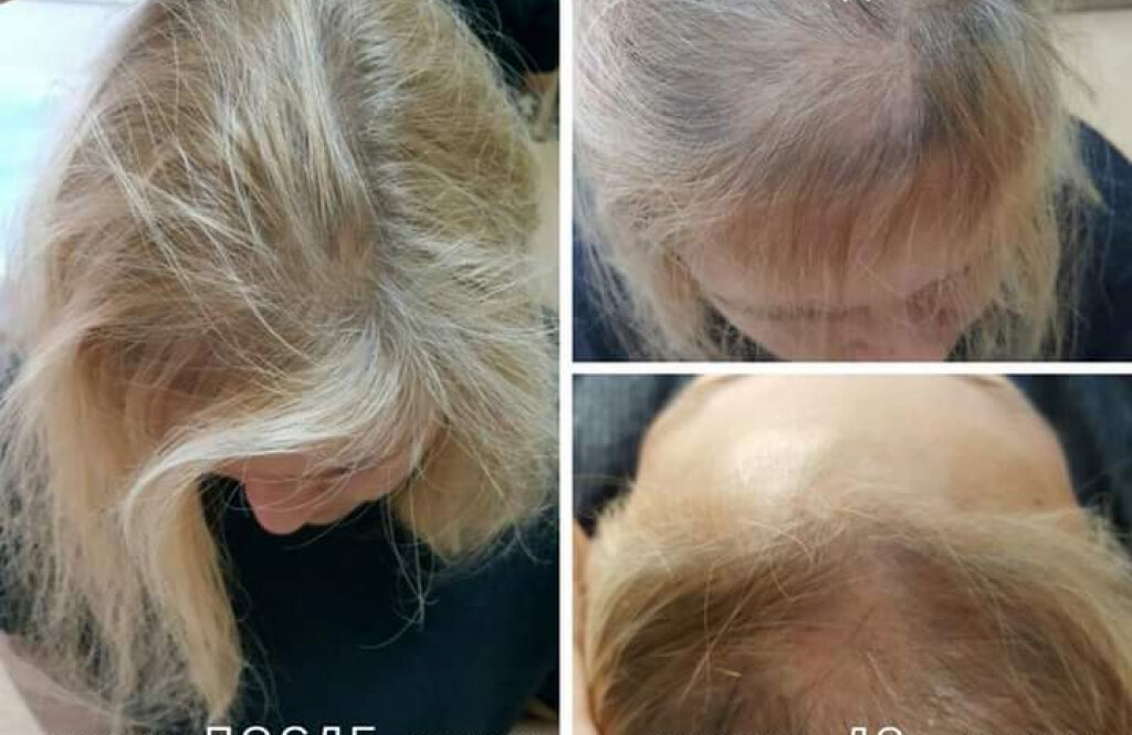 Дерматологія плюс