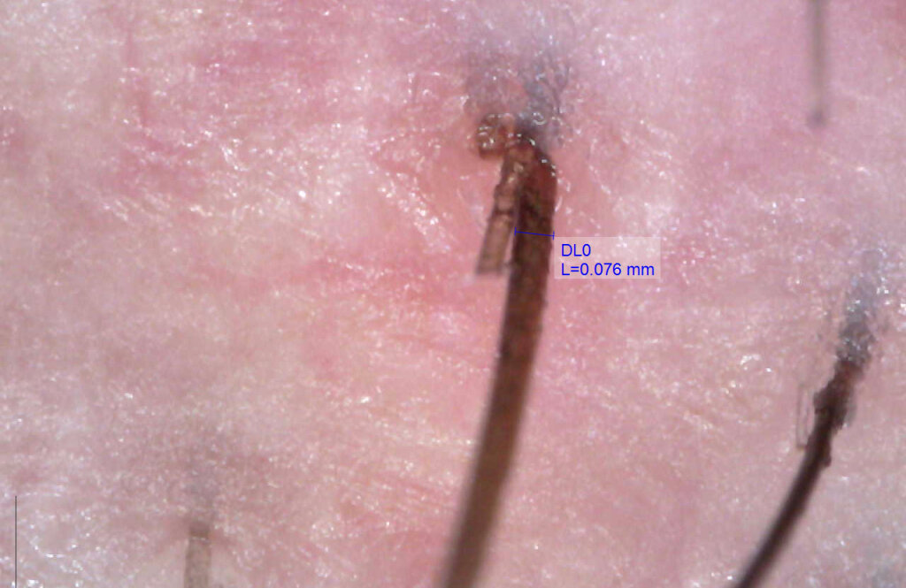 Дерматологія плюс