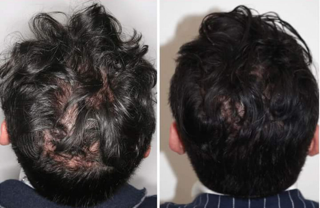 Дерматологія плюс